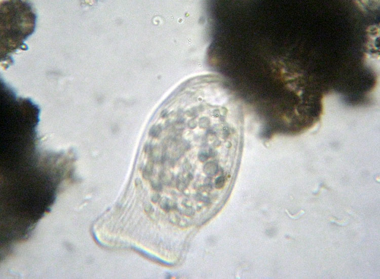 Protozoi del muschio: Spathidium sp